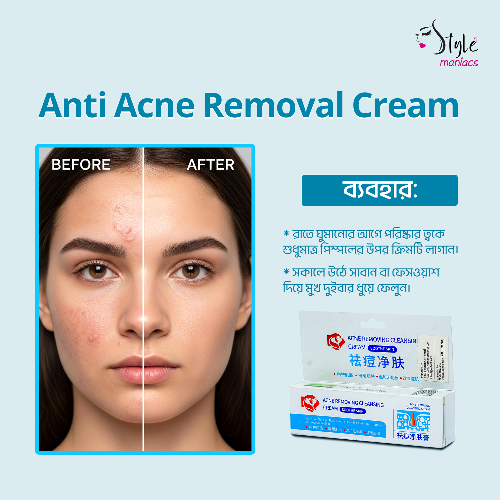Anti Acne Removal Cream - Style Maniacs